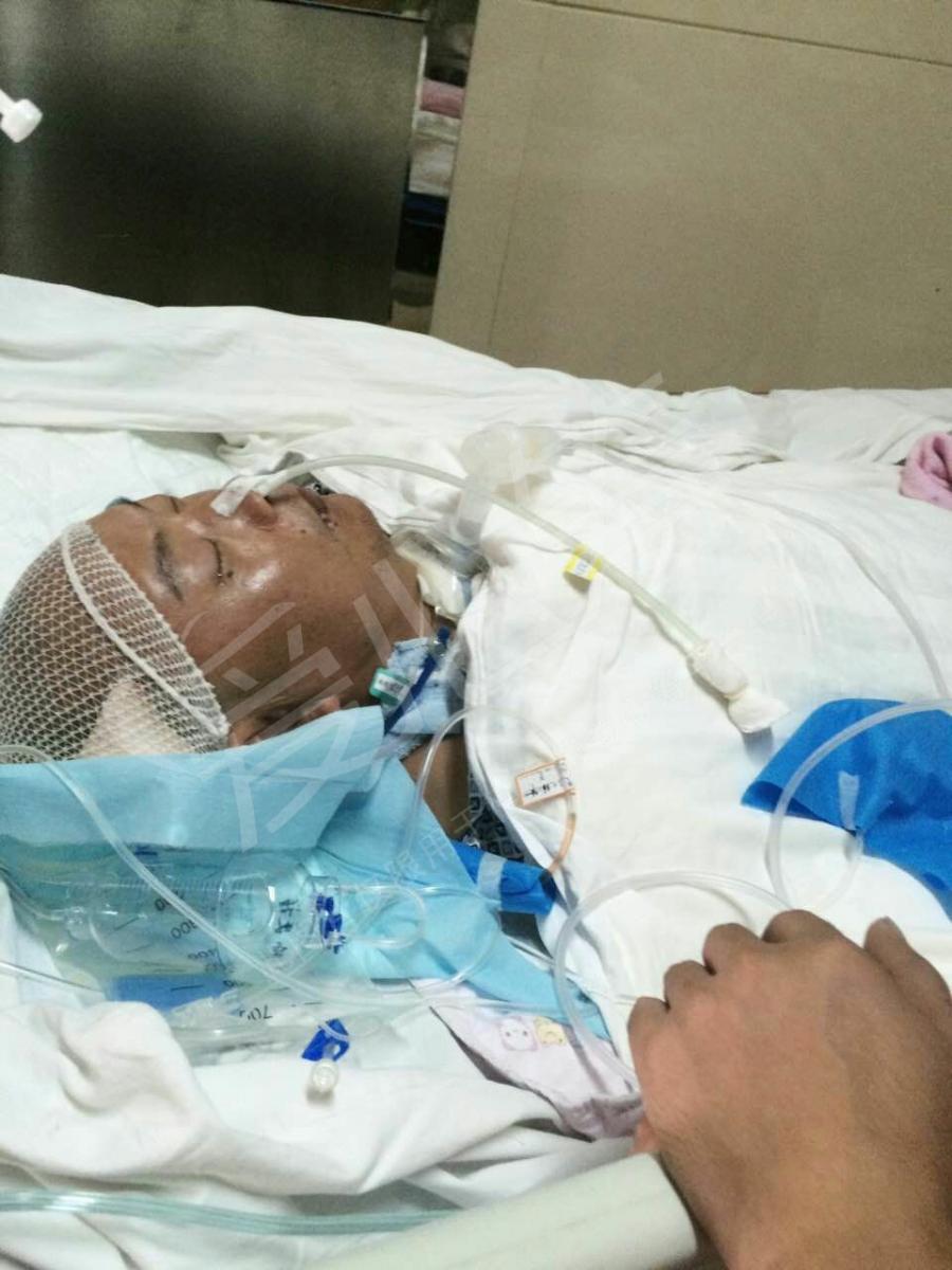 48岁父亲突发高血压脑出血,重度昏迷,现仍在icu(重症监护室)救治,请求