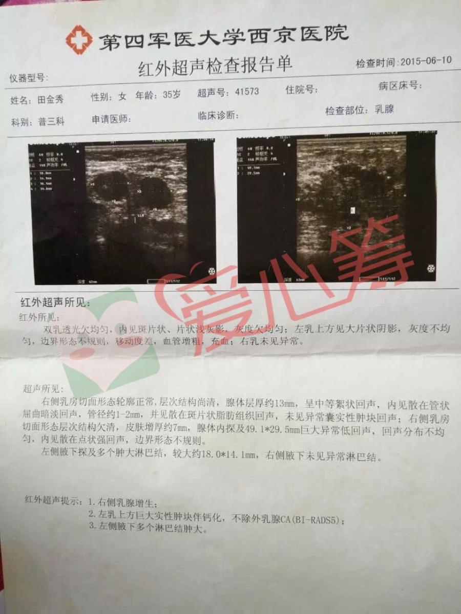 七营患癌妇女乳房溃烂程度触目惊心,我要活下去