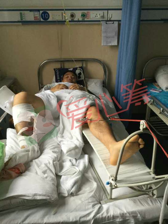 33岁男子遭遇车祸,双腿粉碎性骨折