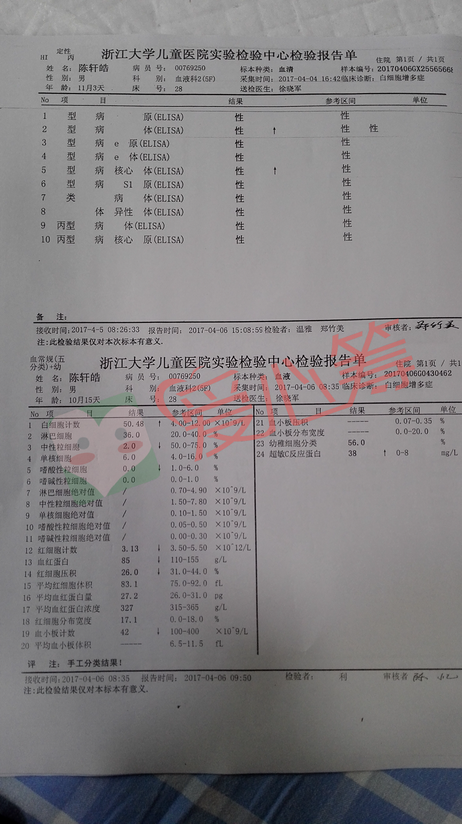 10个月儿子身患白血病,请大家救救我的儿子!