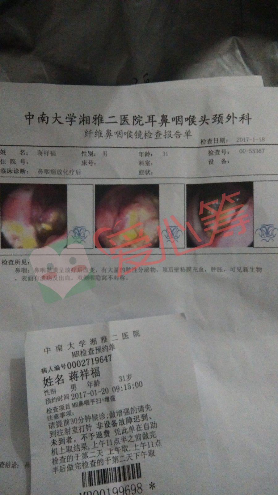 牵爱心之手 援患鼻癌32岁弟弟