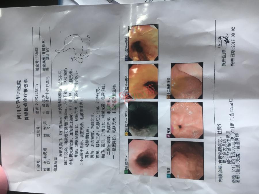 苍溪县农民父亲确诊食管癌前病变,急需治疗,盼望社会爱心人士伸出援手