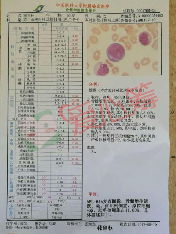 本人患白血病急需骨髓移植!请好心人帮助度过难关!