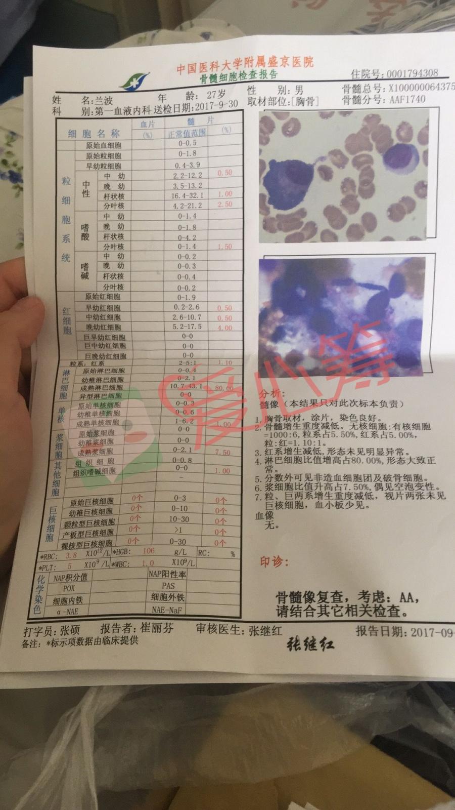 求好心人救救重型再生障碍性贫血需要换骨髓与父亲相依为命的我!