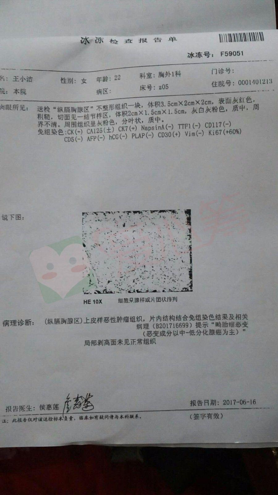 陕西省女孩王小洁确诊纵隔恶性畸胎瘤,急需治疗,恳求您的帮助!