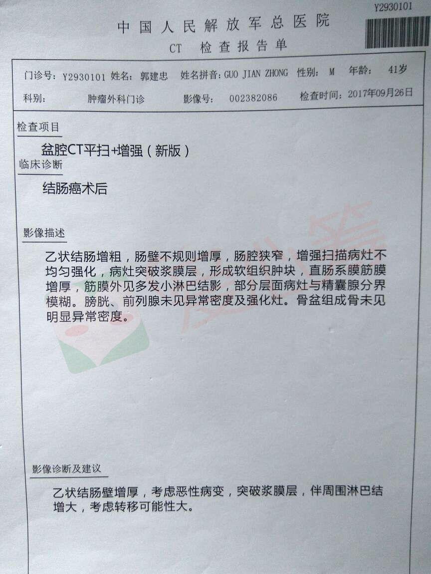 救救我的肛门!继5年前结肠癌术后又发现直肠癌,是否能